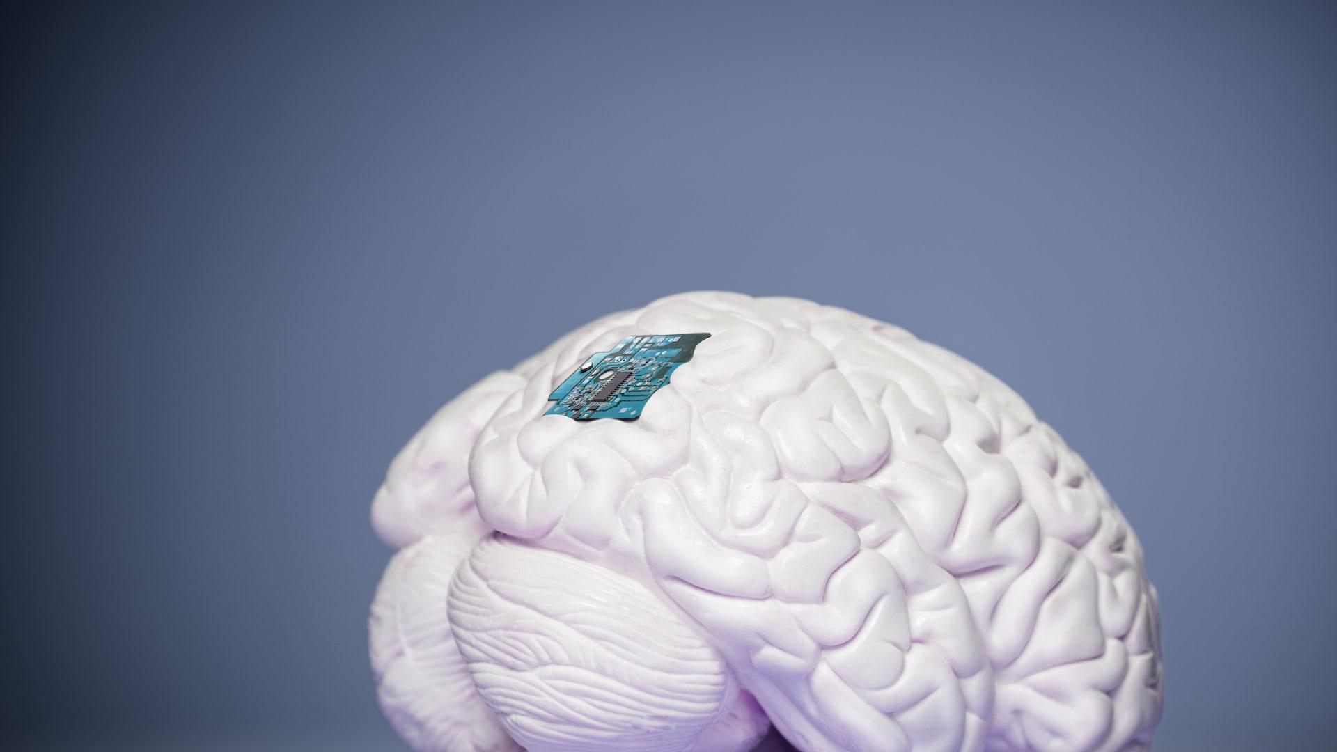 La inserción de electrodos intracerebrales es una técnica que tiene décadas de recorrido