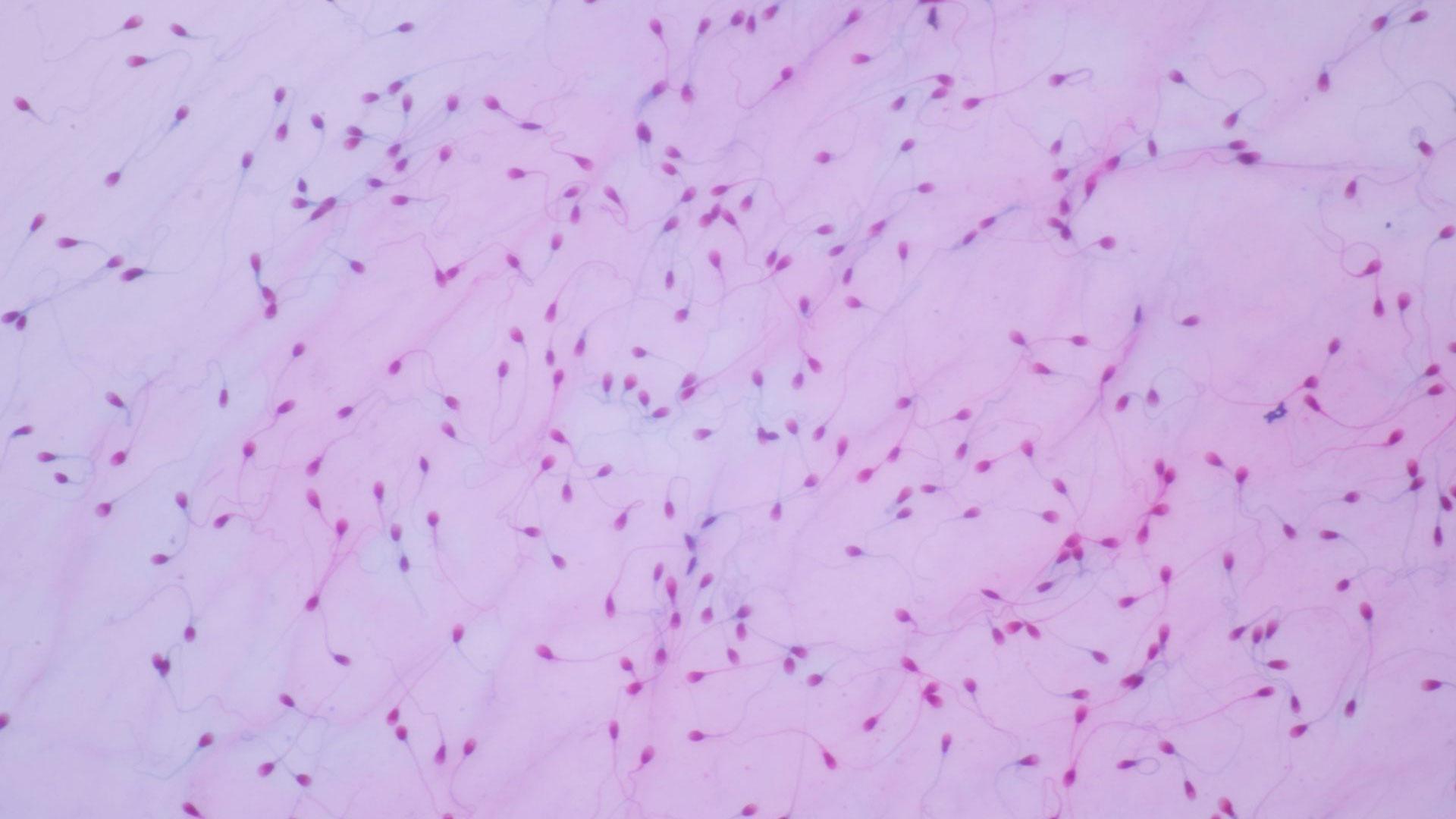 Vista de esperma humano al microscopio