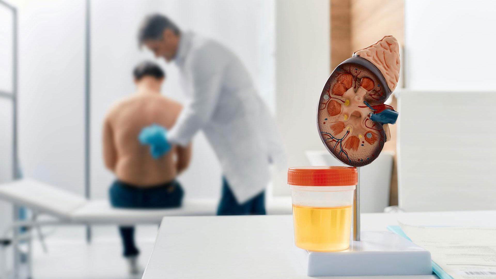 Uno de cada diez adultos en todo el mundo padece enfermedad renal, aunque muchos ni siquiera saben que la tienen