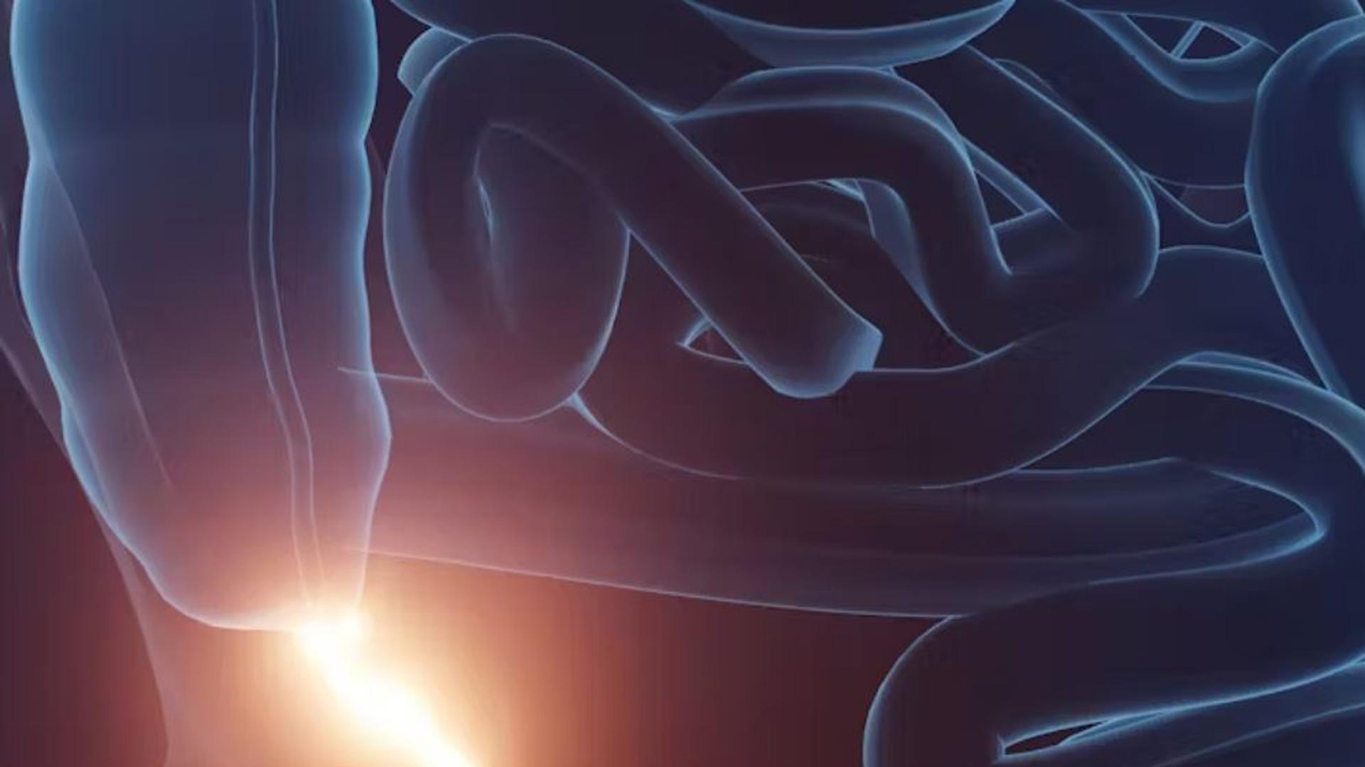 El apéndice es una pequeña bolsa con forma de dedo que se encuentra donde el intestino delgado se une al intestino grueso, en el ciego