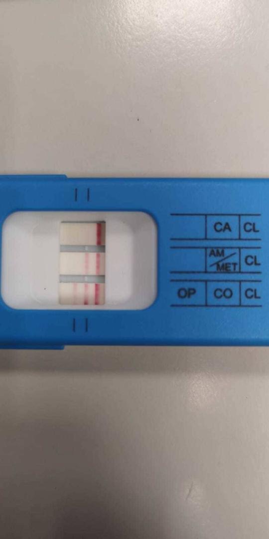 Test de drogas al que se sometió el conductor que se dio a la fuga en Carcastillo