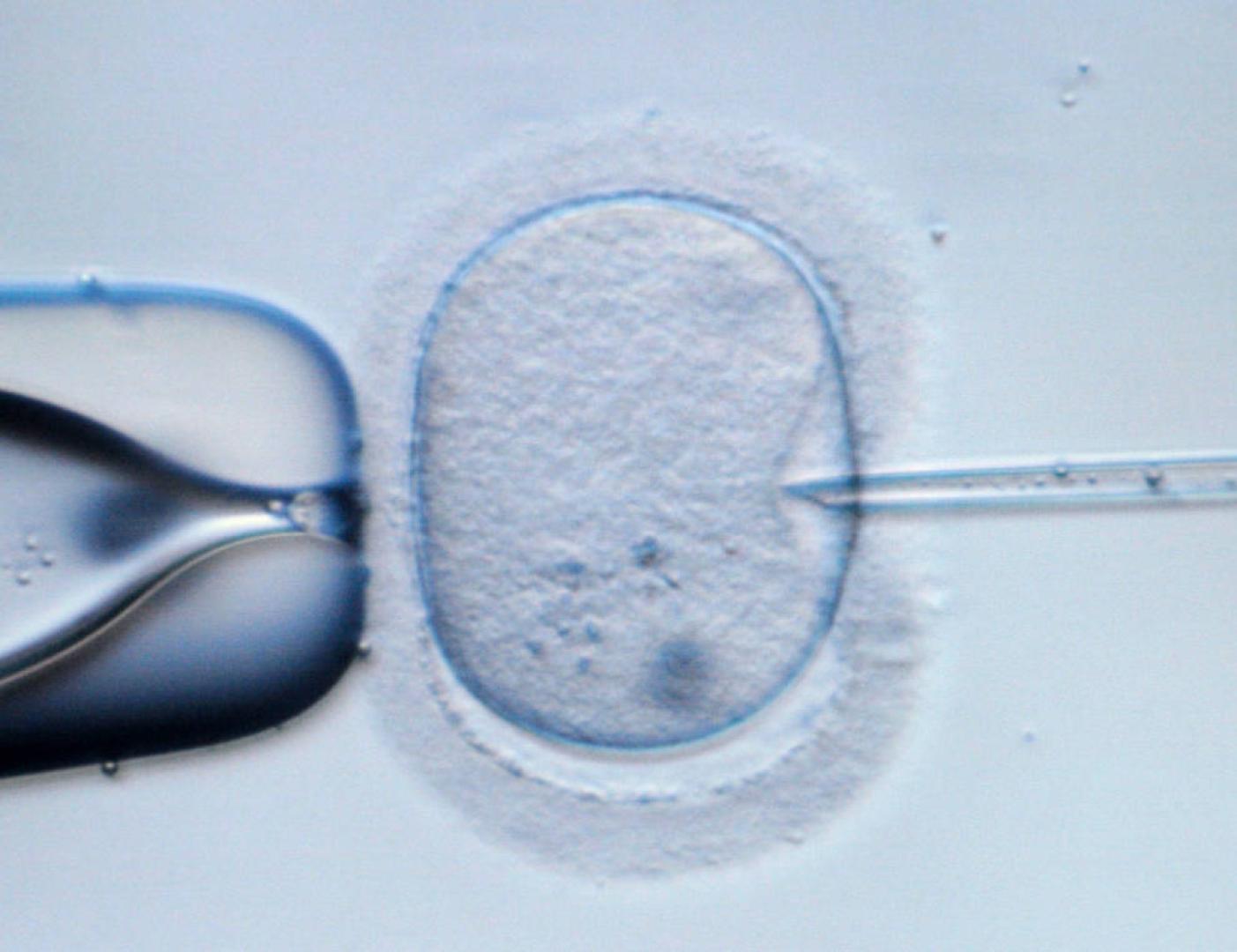 30 años de la primera fecundación in vitro de la Sanidad Pública