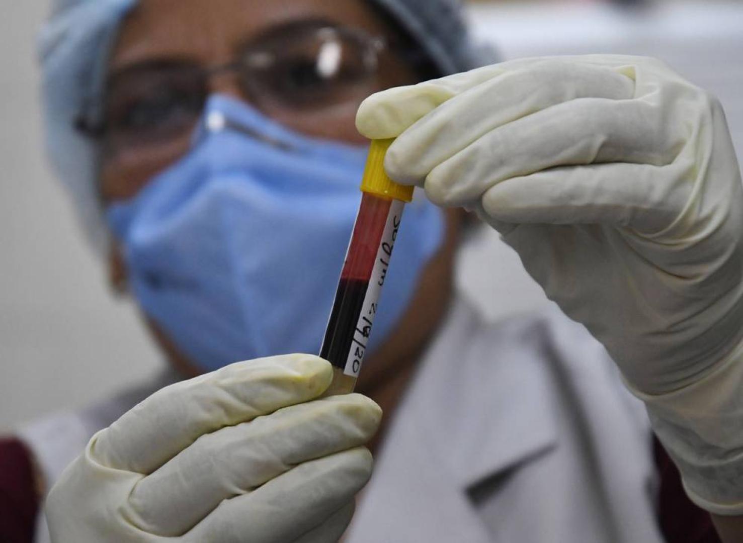 El plasma hiperinmune podría reducir los ingresos en UCI o fallecimientos por covid