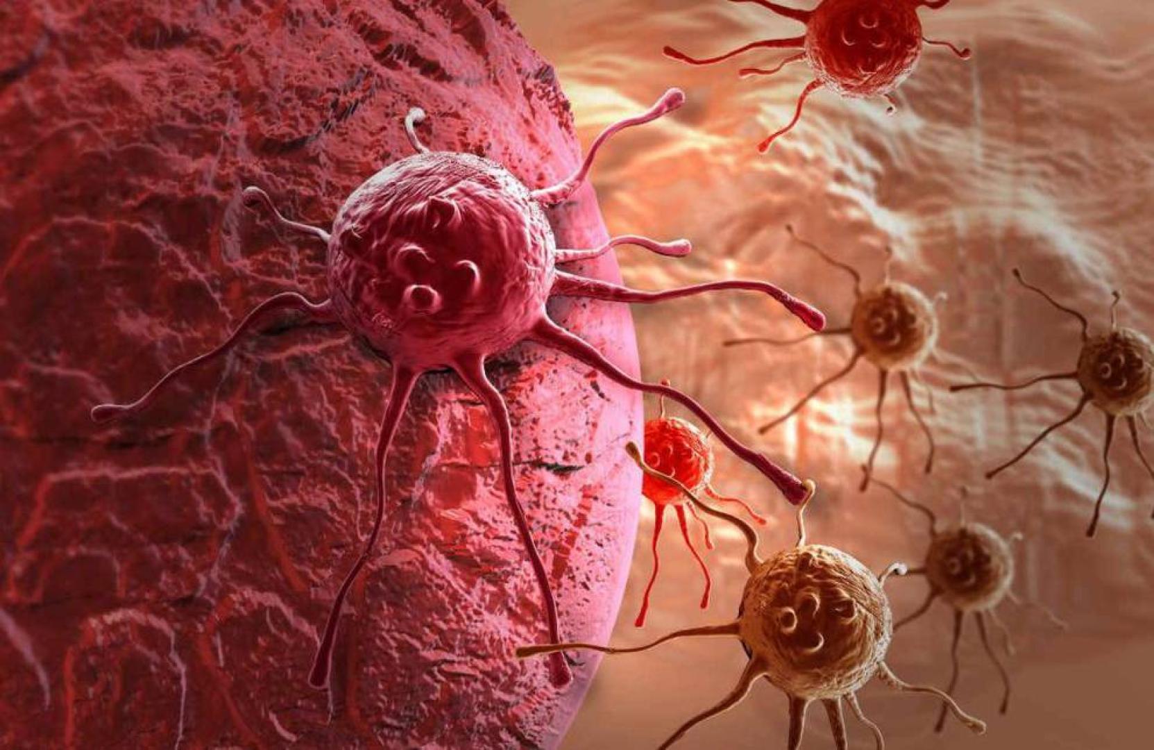 Células tumorales y de cáncer