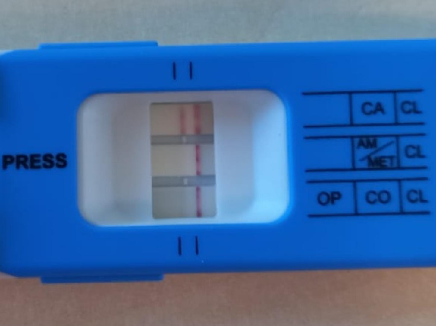Imagen del test de drogas con resultado positivo del conductor de patinete