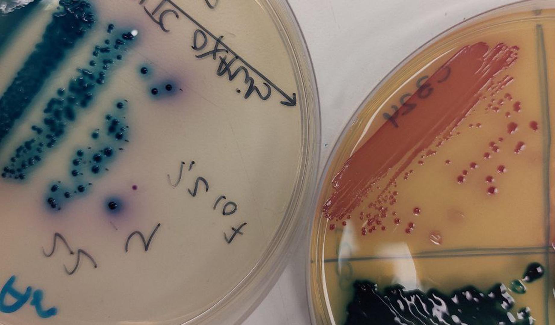 Placas de petri con cultivos de bacterias resistentes a antibióticos aisladas de pacientes. En azul puede observarse a ‘Klebsiella pneumoniae’, y en rojo, a ‘Escherichia coli’