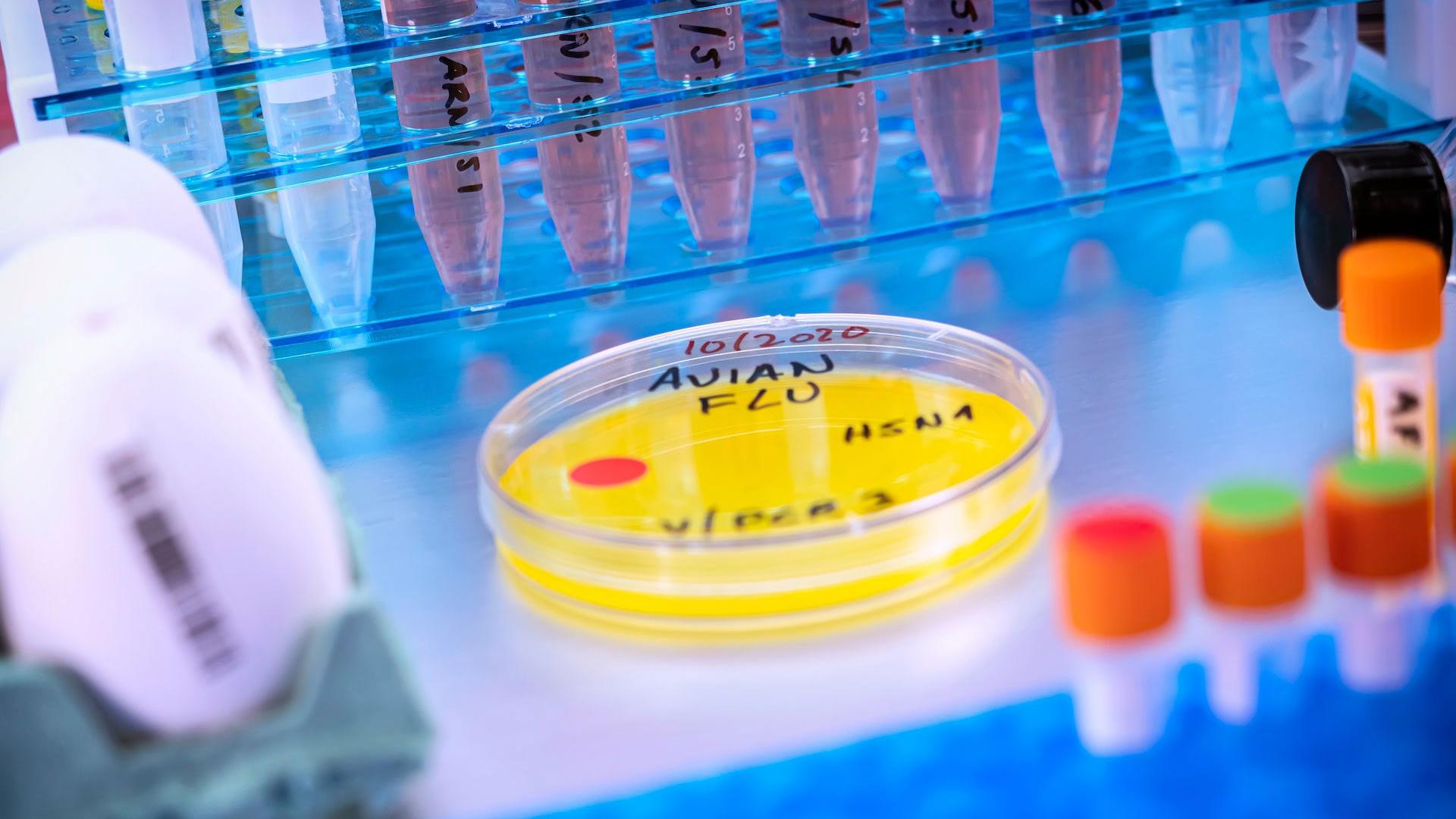 Para que el virus de la gripe aviar H5N1 acabase siendo pandémico debería mejorar su capacidad para transmitirse por vía aérea entre mamíferos y ser capaz de evadir el sistema inmunitario humano