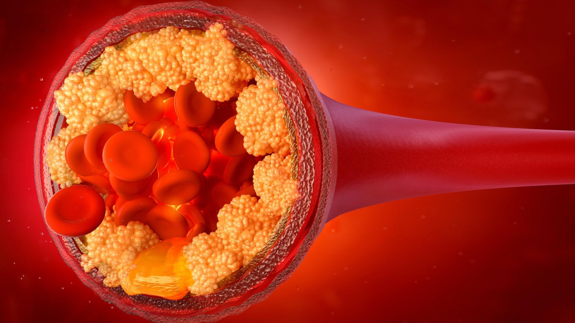 El colesterol es un lípido (grasa) presente en todas las células del cuerpo e indispensable para el organismo