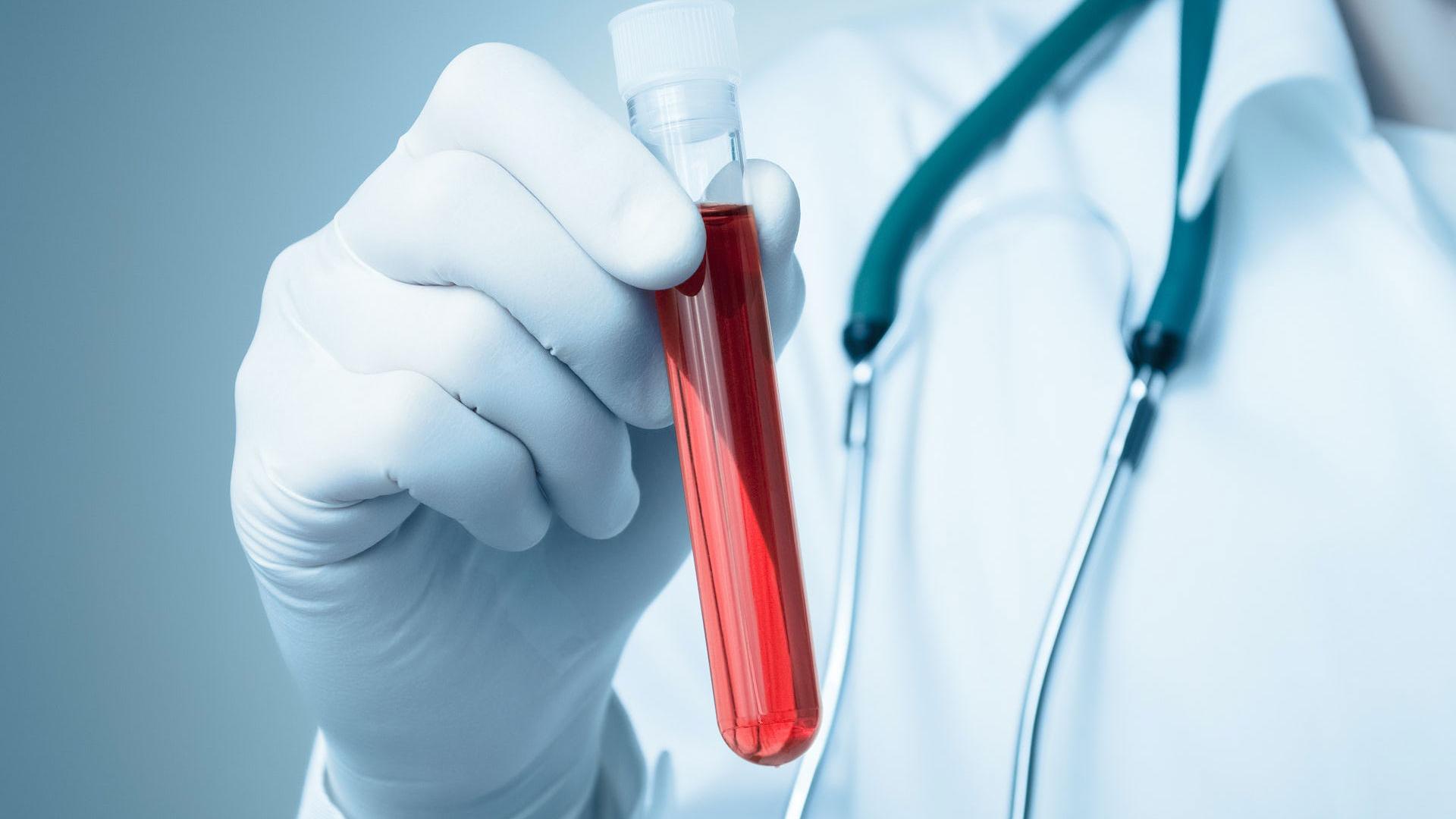 En los últimos tiempos los análisis se han diversificado y la información que se extrae de una muestra de sangre no siempre depende de lo que hayamos comido en las horas previas