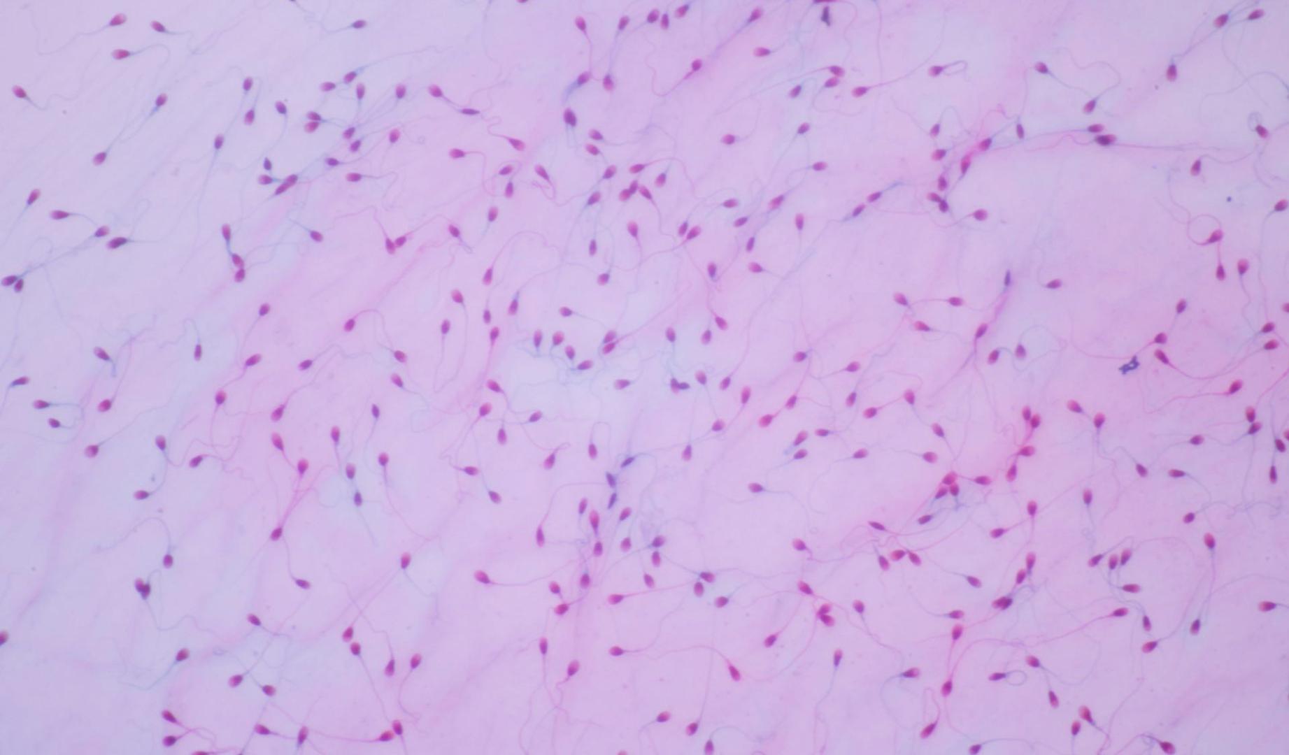 Vista de esperma humano al microscopio