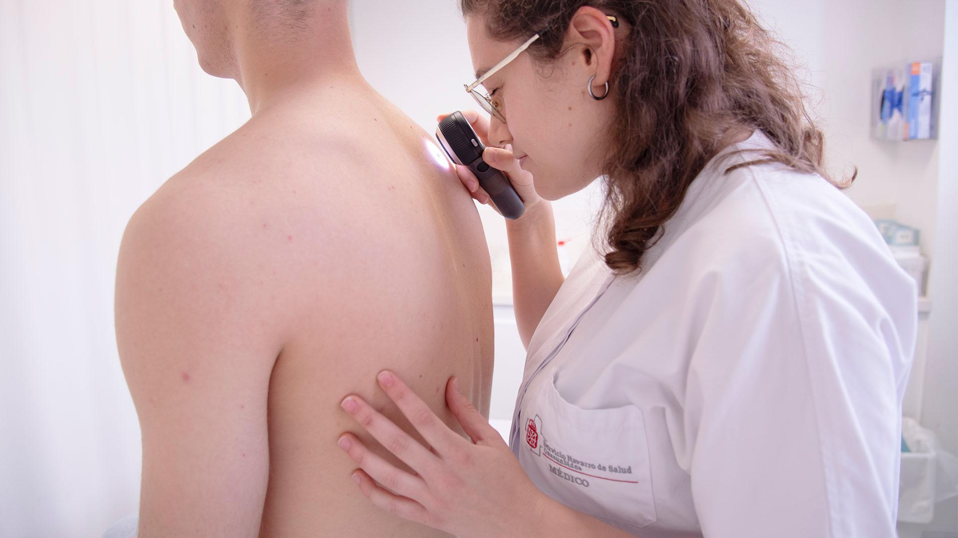 Exploración con dermatoscopio para prevenir el melanoma en el HUN