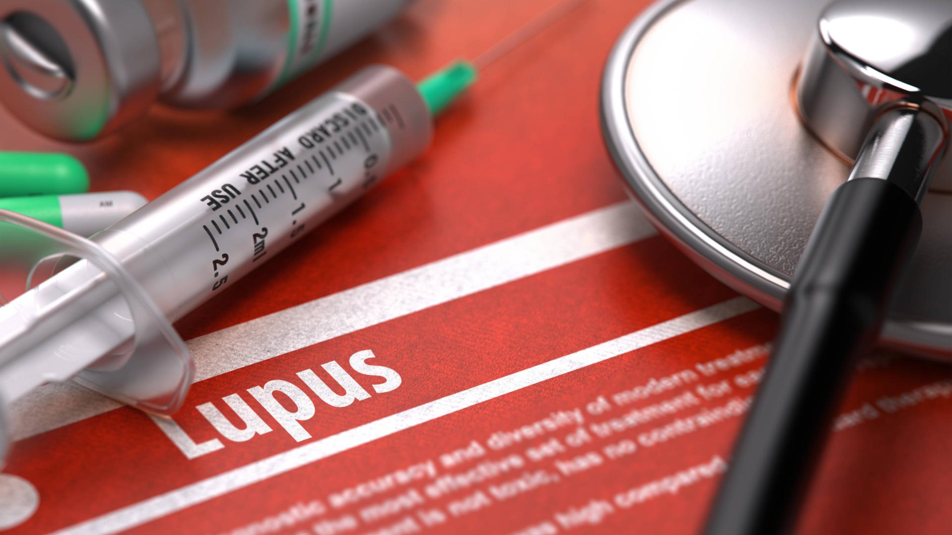 Diagnóstico de lupus