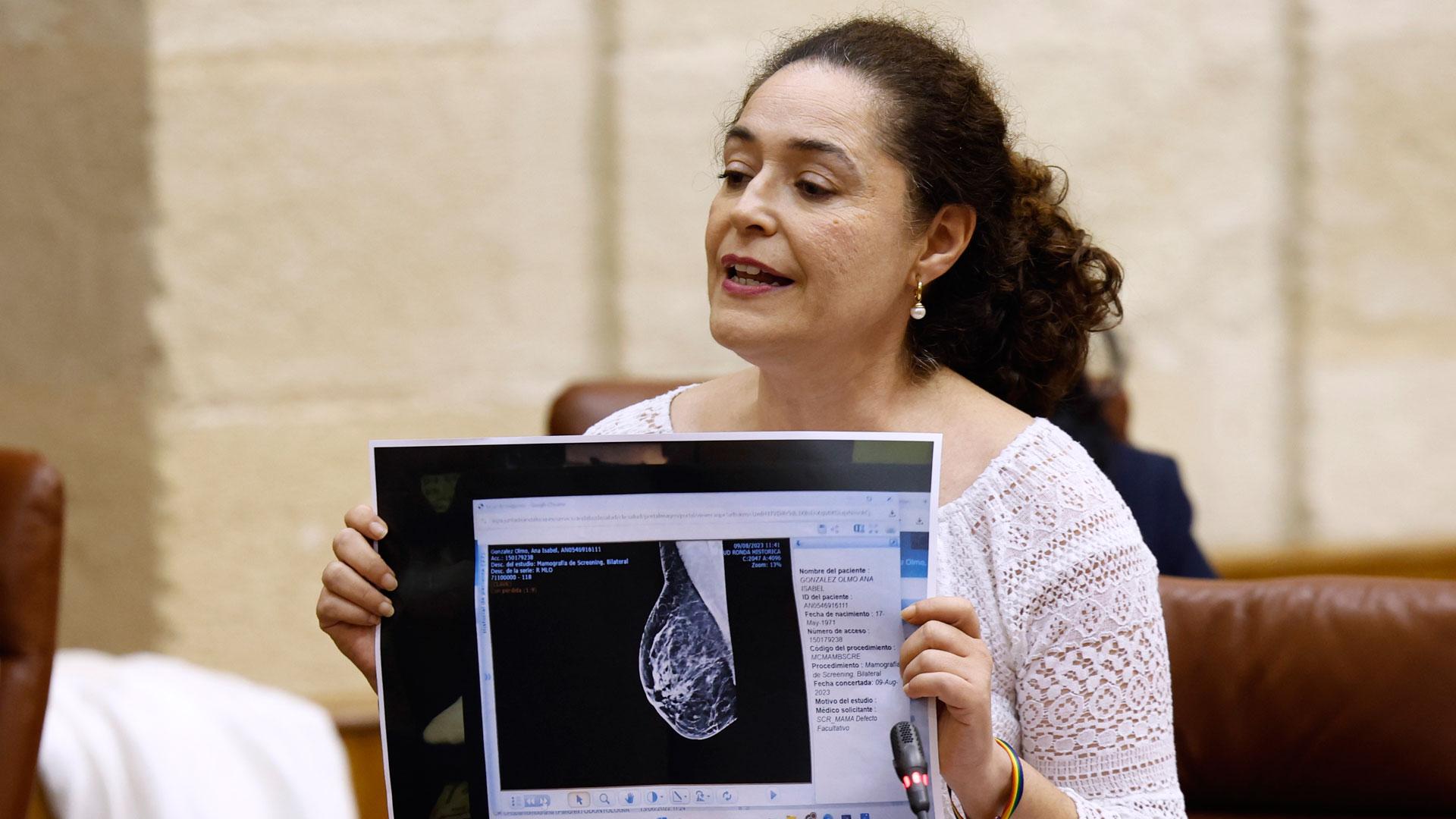 La portavoz de Por Andalucía, Inmaculada Nieto, muestra una mamografía durante su intervención en el pleno del Parlamento autonómico en el que se debaten los fallos en los cribados del cáncer de mama