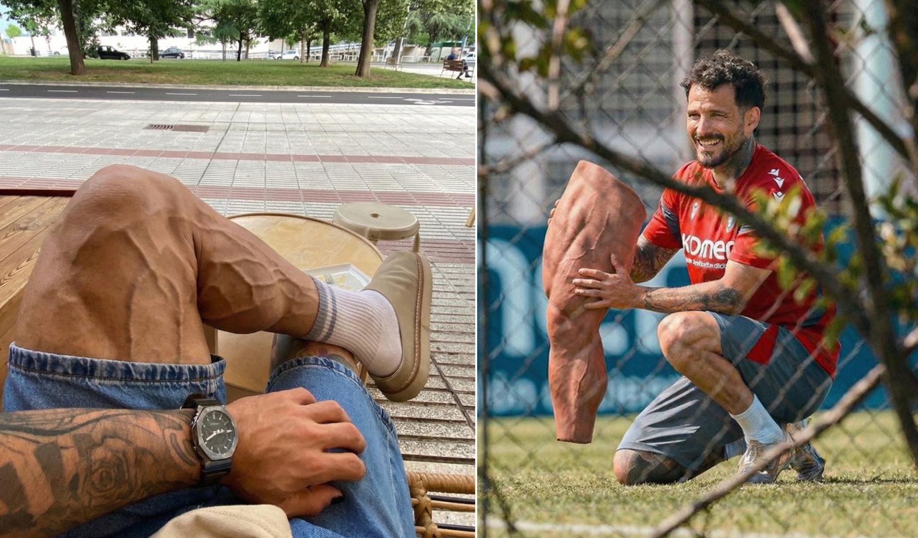 Imágenes que ha publicado Rubén García sobre su pierna izquierda