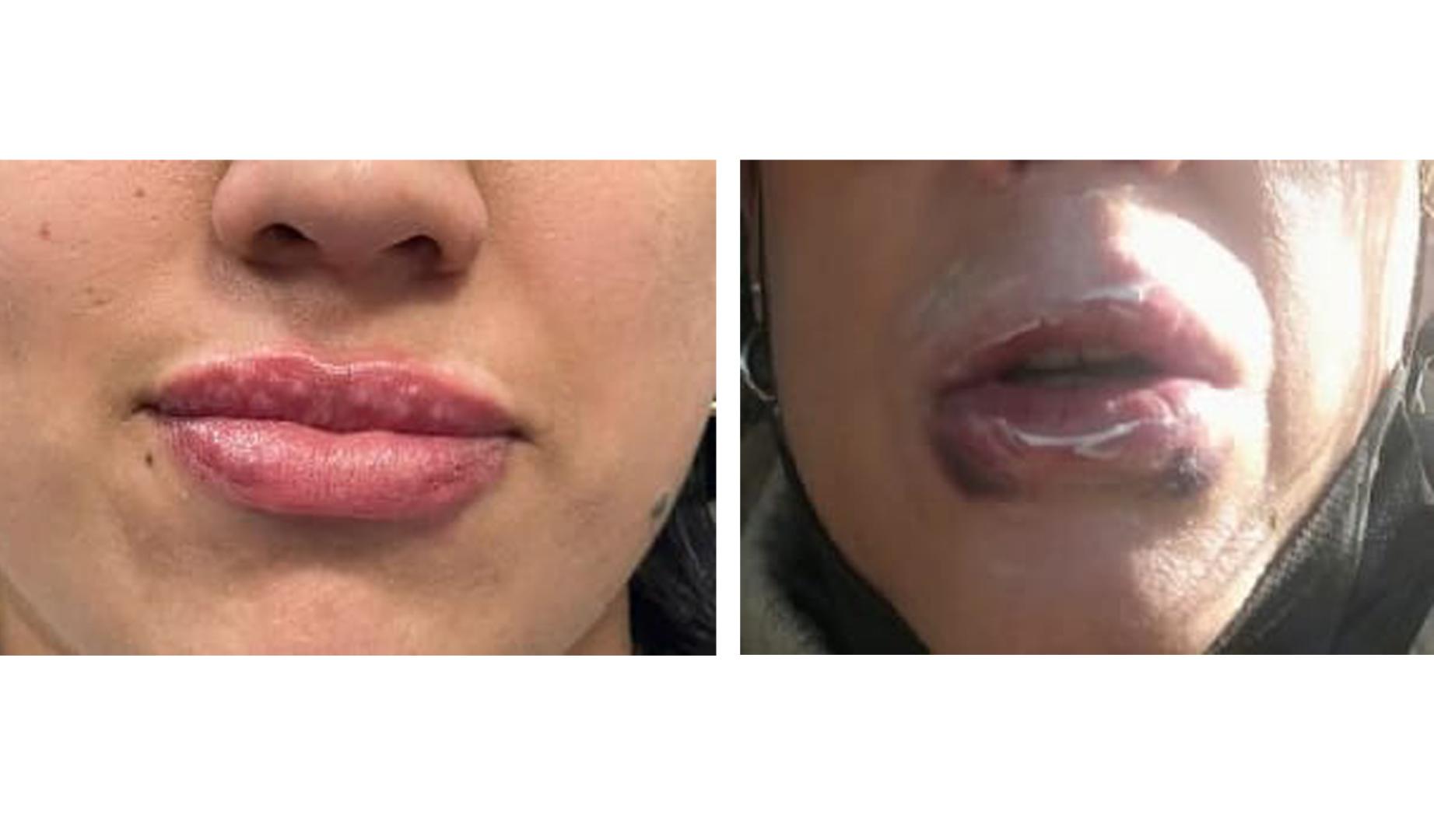 Imagen de dos de las víctimas de la clínica de labios de Pamplona