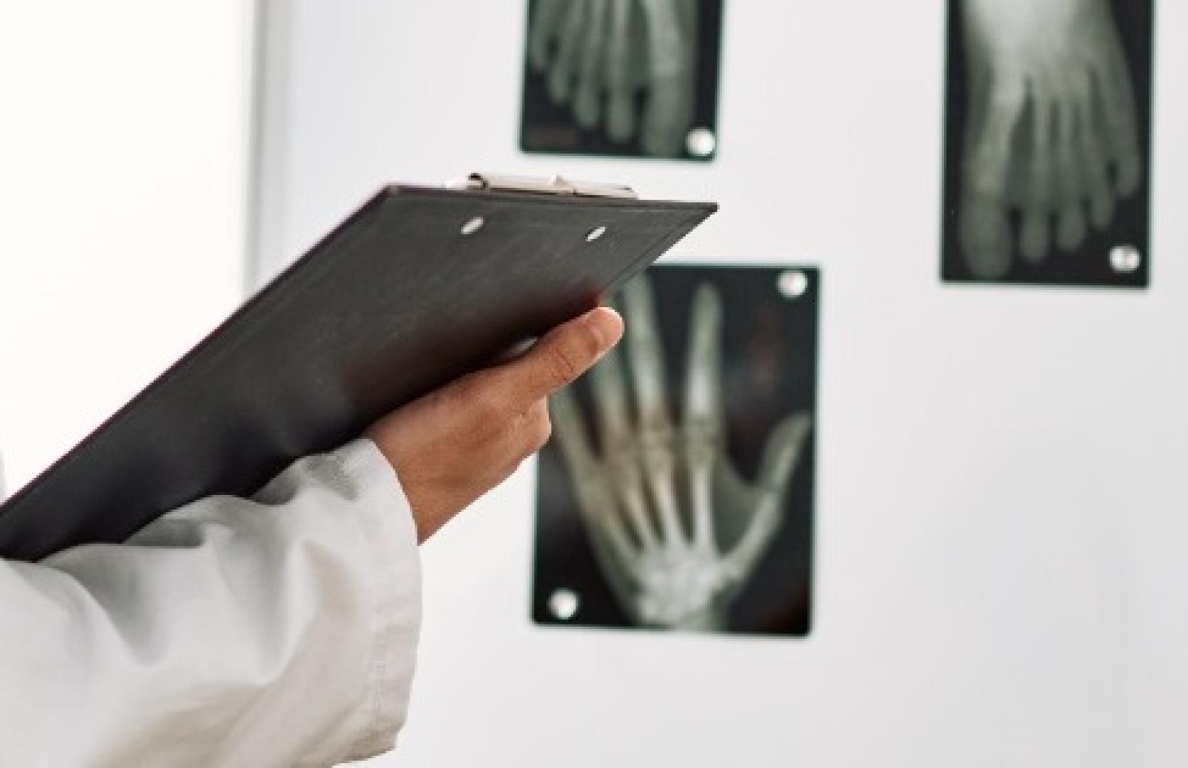 Unas radiografías expuestas en una consulta