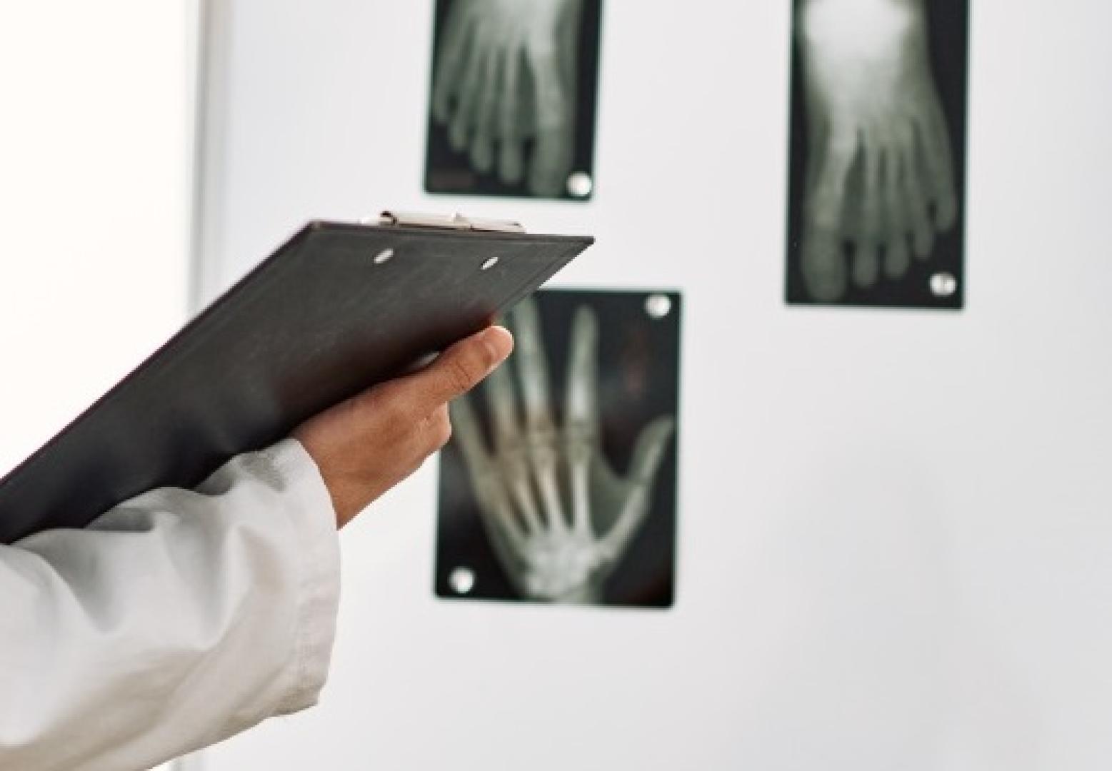 Radiografías en una consulta