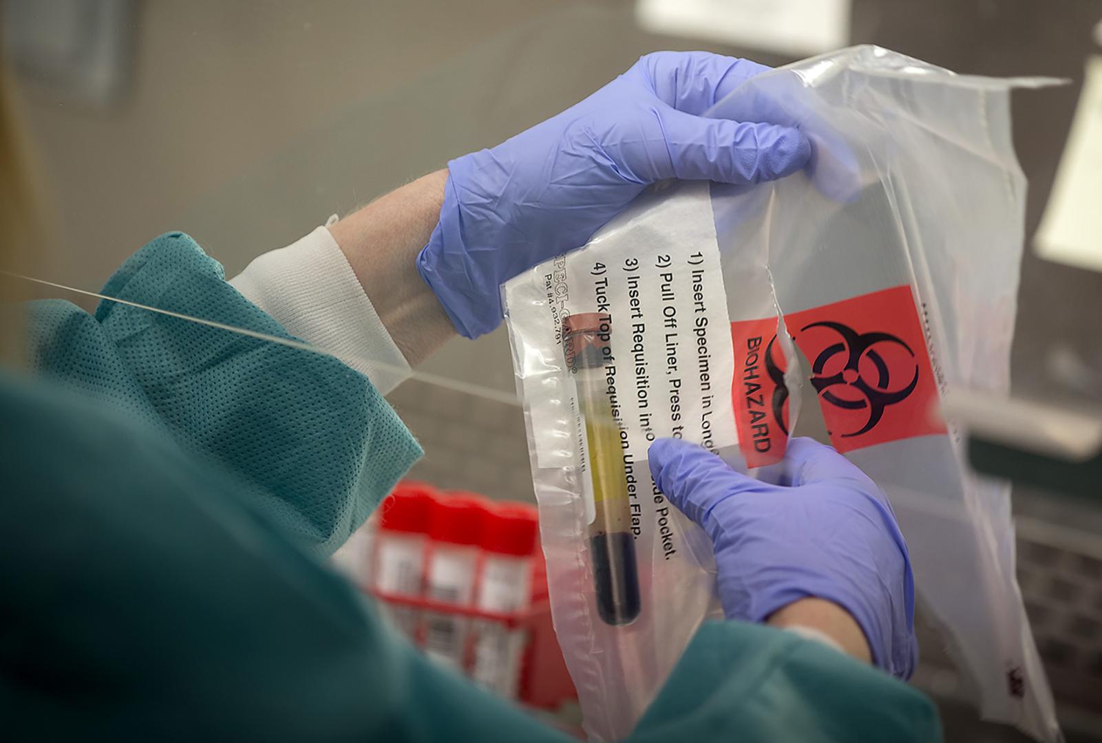 Foto de archivo de un técnico de laboratorio del departamento de salud de Minnesota en Estados Unidos con tubos de saliva de pacientes para testarla por sarampión.