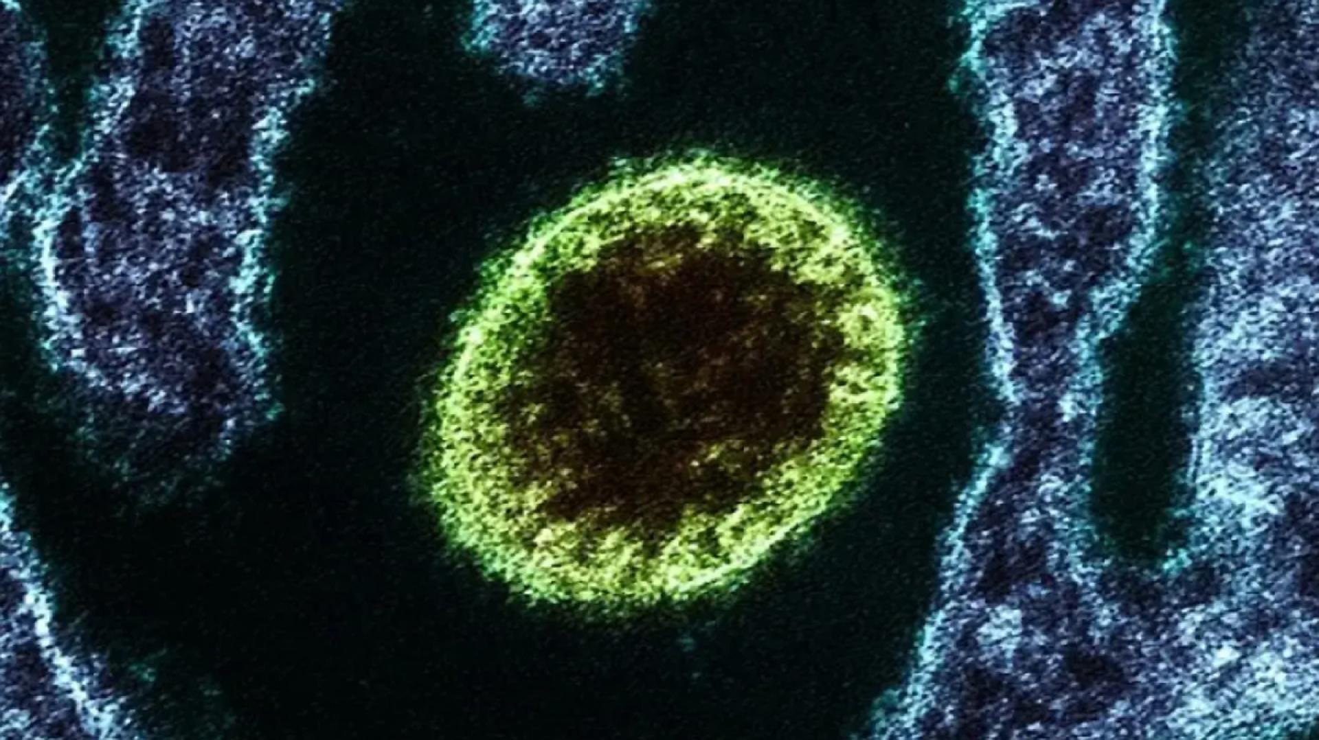Imagen de archivo del virus Nipah