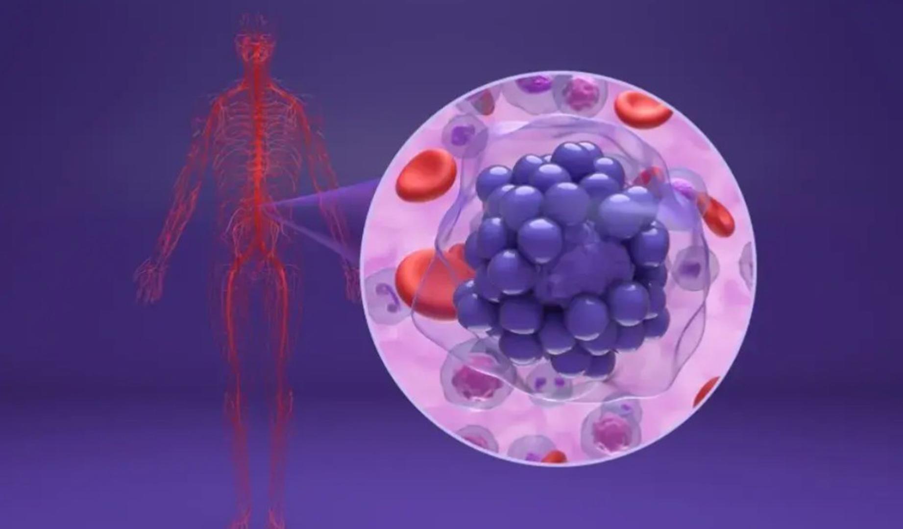 La molécula microARN miR-28 reduce resistencia a ibrutinib, fármaco empleado en un tipo agresivo de linfoma de células B