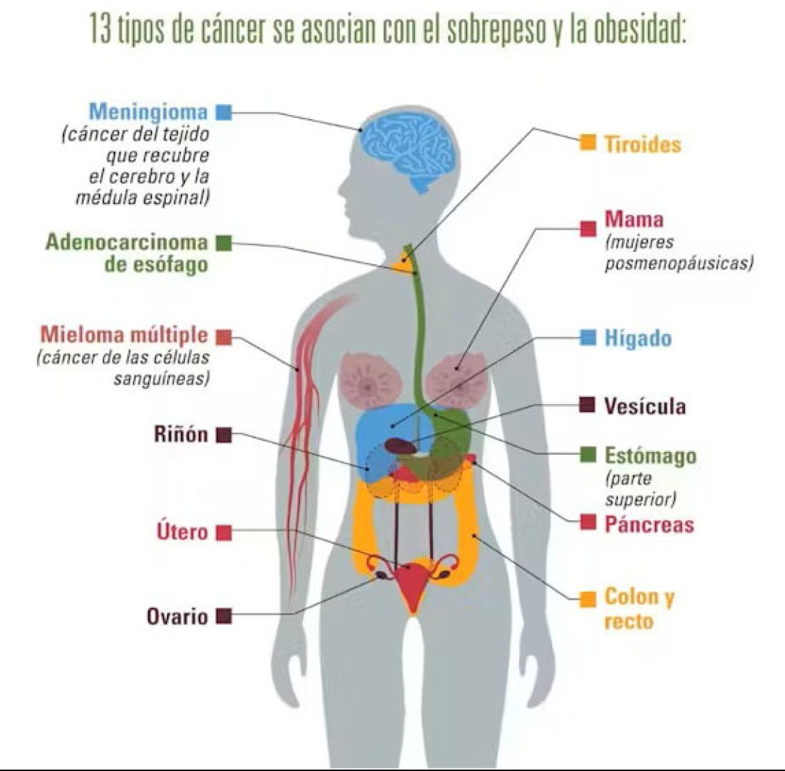 Cánceres asociados a la obesidad