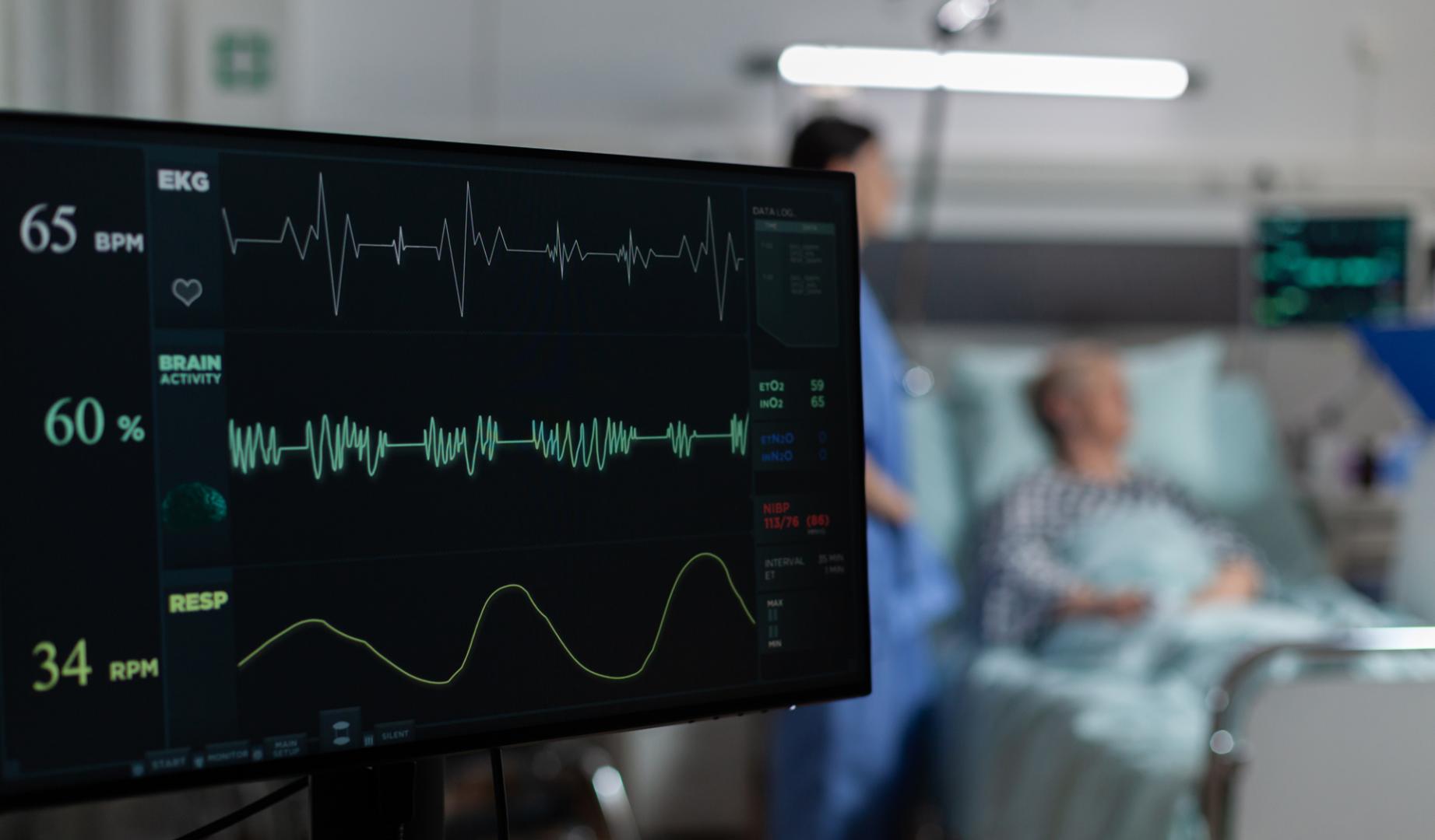 Imagen de archivo de un cardiograma