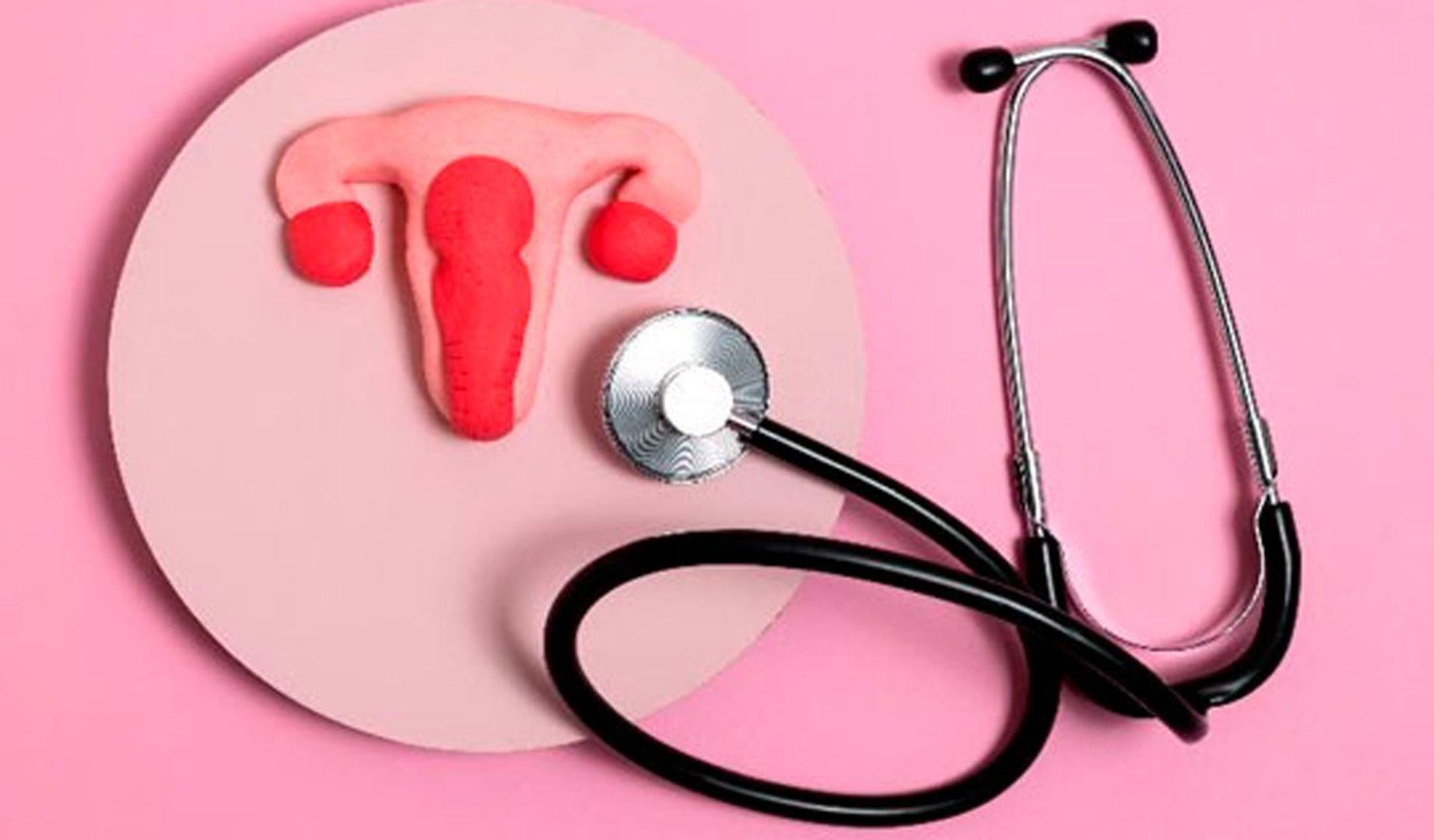 Imagen de archivo representativa del cáncer de ovarios