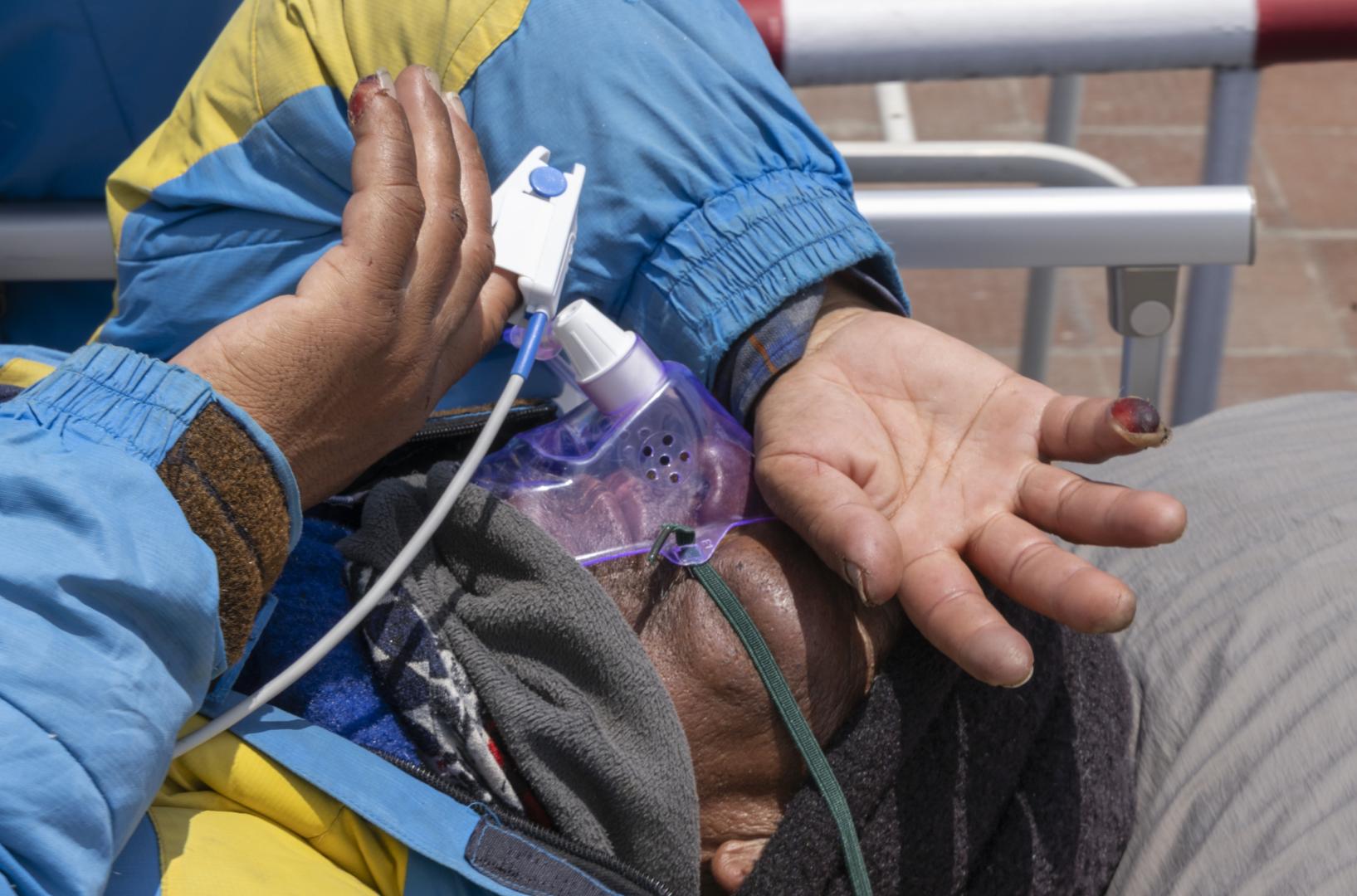 Dawa Sherpa, a su llegada al hospital en Katmandú con evidentes daños en sus dedos por las congelaciones