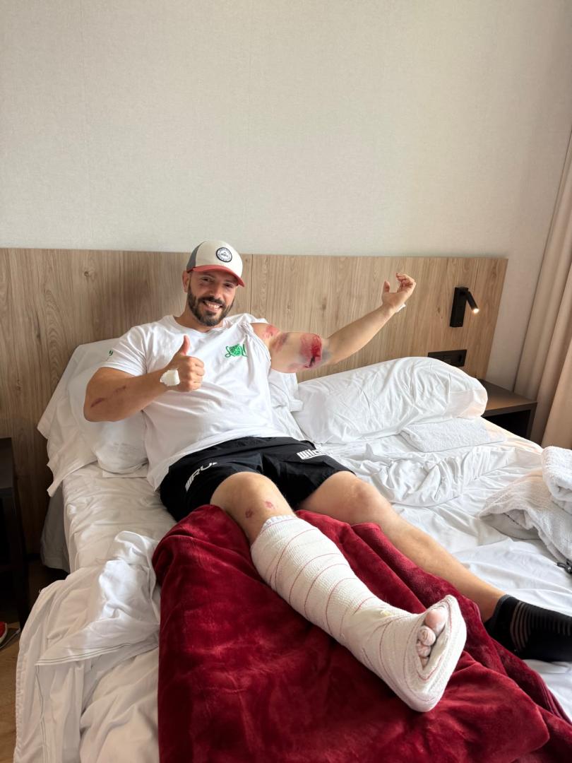Ander Etxanobe Iturri con la pierna derecha vendada, en el hotel donde se aloja estos Sanfermines