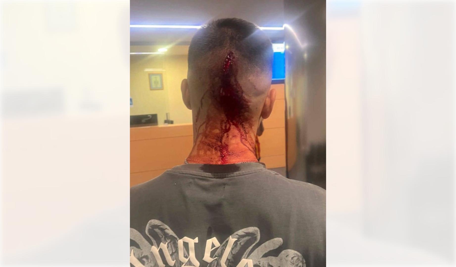 Imagen de las heridas de uno de los agredidos en Berriozar