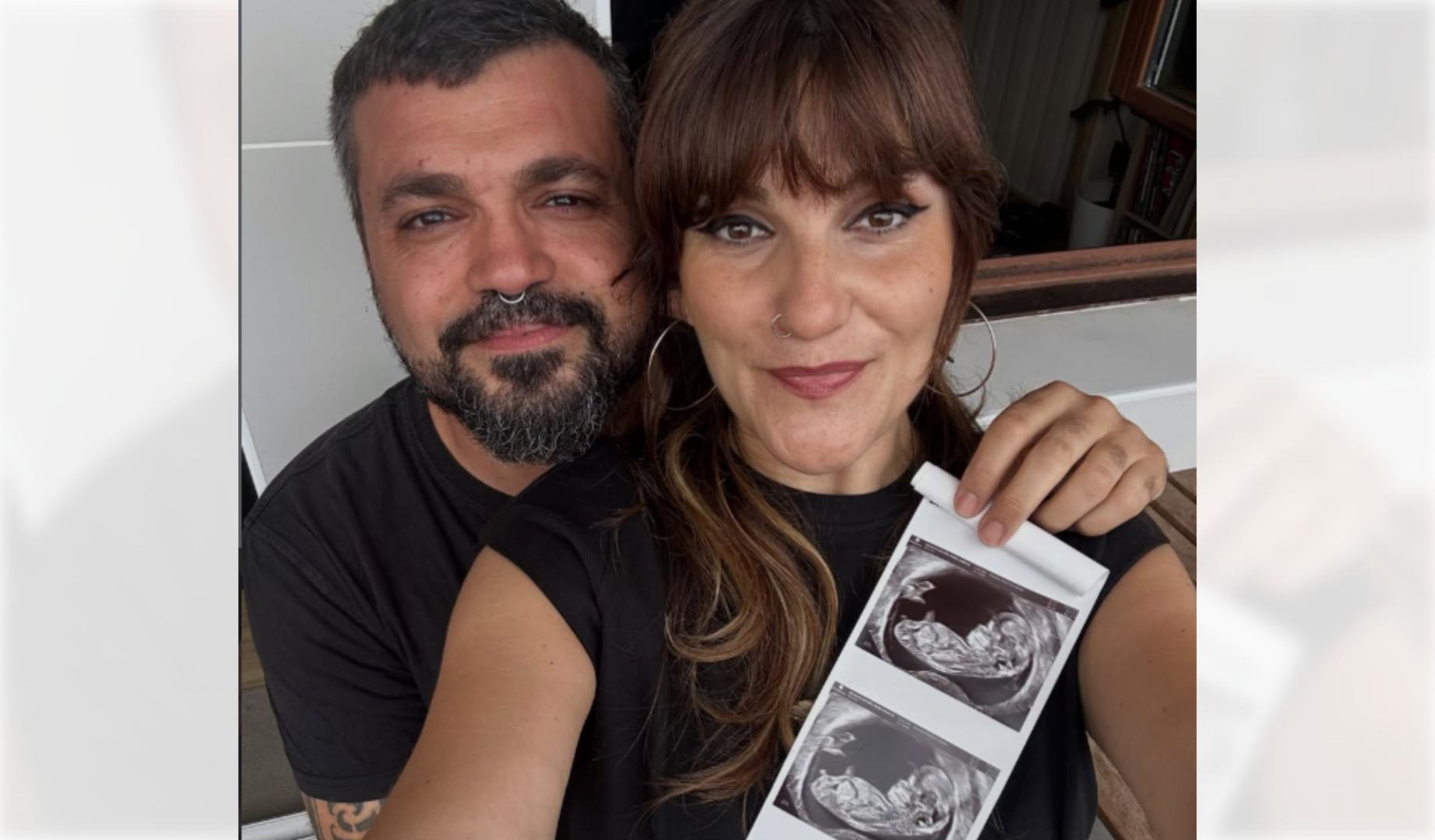 Rozalen, junto a su pareja Bonzo, muestran la ecografía del que será su primer hijo
