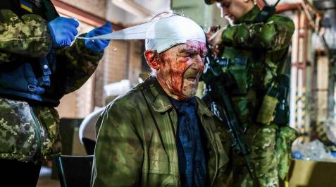 Severodonetsk Una persona herida recibe asistencia tras los enfrentamientos en Severodonetsk