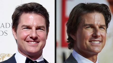 El actor Tom Cruise estrena cara en los Bafta 2016 El actor Tom Cruise estrena cara en los Bafta 2016