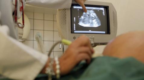 3 de cada 10 mujeres en tratamiento de fertilidad no tienen pareja 3 de cada 10 mujeres en tratamiento de fertilidad no tienen pareja