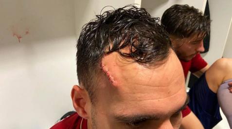 La brecha de Unai García en el Elche-Osasuna La brecha de Unai García en el Elche-Osasuna