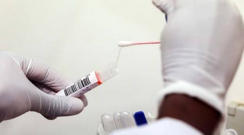 Médicos de atención primaria denuncian su falta de recursos y de test rápidos Médicos de atención primaria denuncian su falta de recursos y de test rápidos