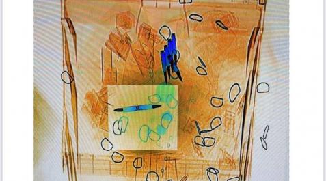 Imagen del escáner con las balas. Imagen del escáner con las balas.