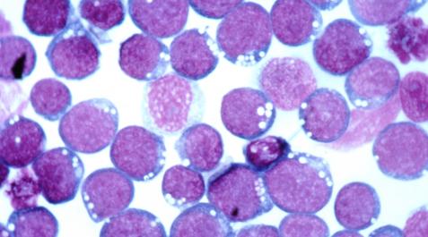 Virus de Epstein-Barr. Virus de Epstein-Barr