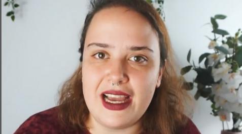 CARLOTA-QUIROGA La instagramer Carlota Quiroga sufre alopecia androgenética desde los 14 años