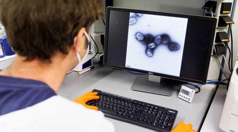 Un científico observa la imagen microscópica del virus de la viruela del mono a través de un ordenador Un científico observa la imagen microscópica del virus de la viruela del mono a través de un ordenador