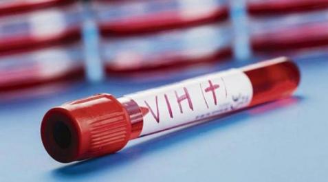 vih España guarda 130 cordones umbilicales resistentes al VIH para trasplantes
