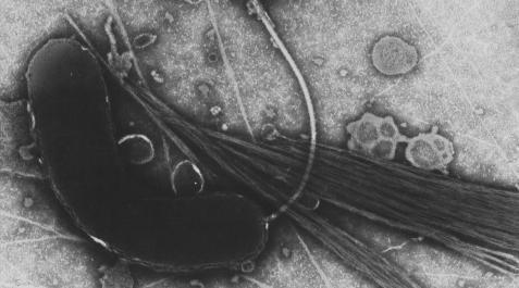 colera Bacteria del cólera