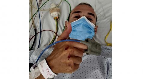 Alejandro Valverde tras ser atropellado Alejandro Valverde tras ser atropellado