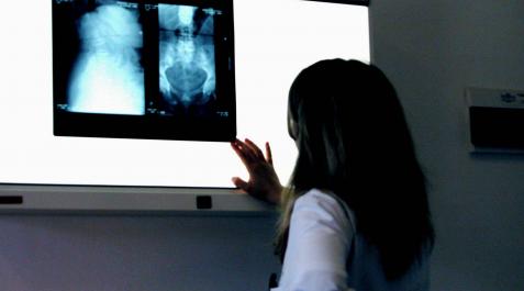sanitaria placas Una sanitaria analiza unas placas en una pantalla