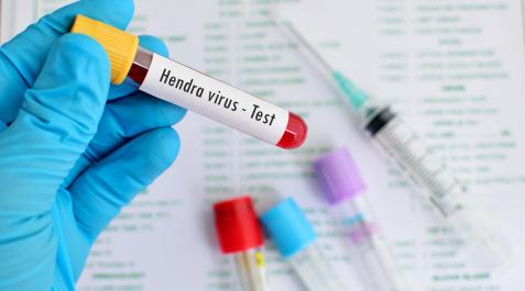 Sangre en una muestra del virus Hendra Sangre en una muestra del virus Hendra