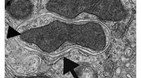 celulas Imagen de microscopía electrónica de transmisión de una vesícula autofágica en el riñón de un ratón