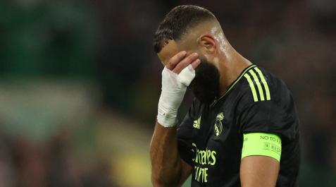 Karim Benzema se retira lesionado en el duelo de Champions contra el Celtic Karim Benzema se retira lesionado en el duelo de Champions contra el Celtic