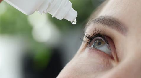 Una mujer se pone gotas en los ojos para evitar la sequedad Una mujer se pone gotas en los ojos para evitar la sequedad