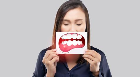 PERIODONTITIS-ENCIASs Entre 8 y 9 de cada 10 personas mayores de 35 años presentan alguna enfermedad de las encías: gingivitis o periodontitis
