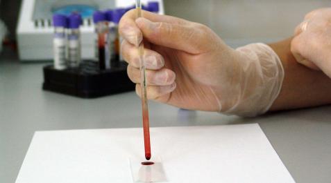 sangre Análisis de sangre en un laboratorio